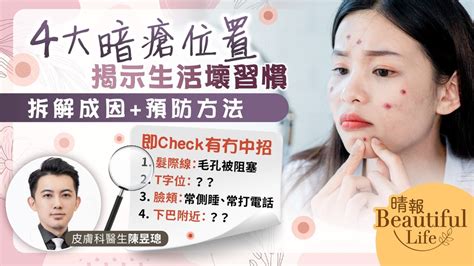 面頰 生 暗瘡|9大暗瘡位置：下巴暗瘡=腎虧？中醫去暗瘡有用嗎？